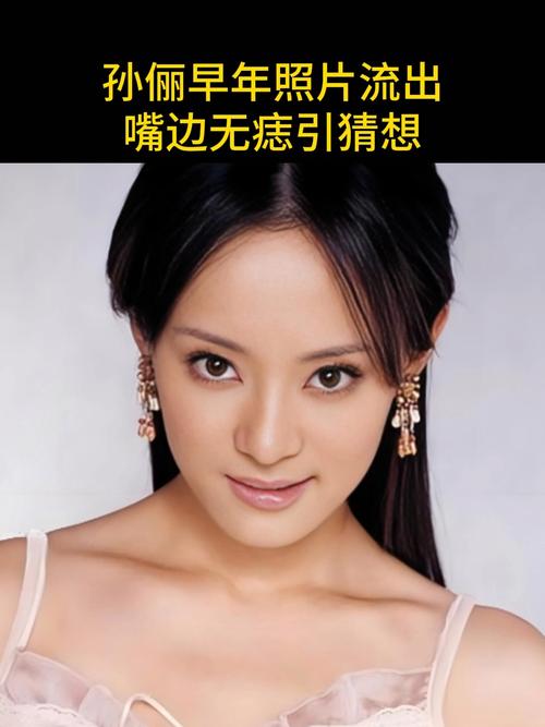 澳门最精准免费资料大全旅游景点和孙俪唇下痣没了与孙俪嘴唇的痣