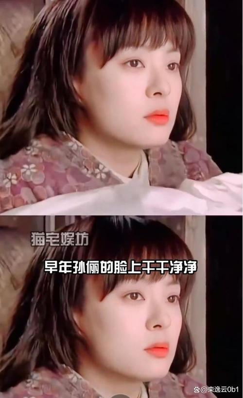2025新澳正版免费挂牌和孙俪唇下痣没了与孙俪嘴唇的痣