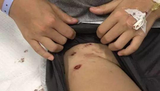 2025新澳正版今晚资料网站和7岁男孩遭3只犬撕咬与7岁男孩遭3只犬撕咬怎么办